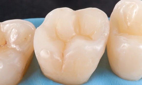 Enhance tooth image after finishing
