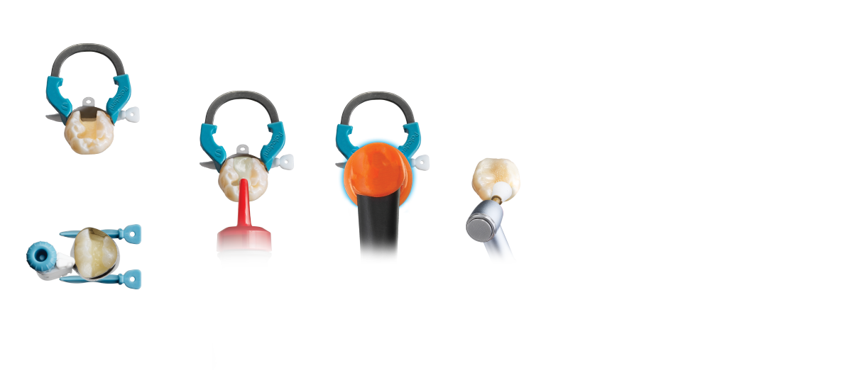Sreamlined Class II Total Practice Solution for challenging Class II Dental Restoration Procedure with products from Dentsply Sirona