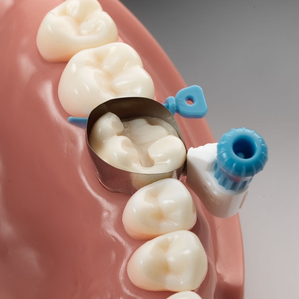 Wedge Palodent 360