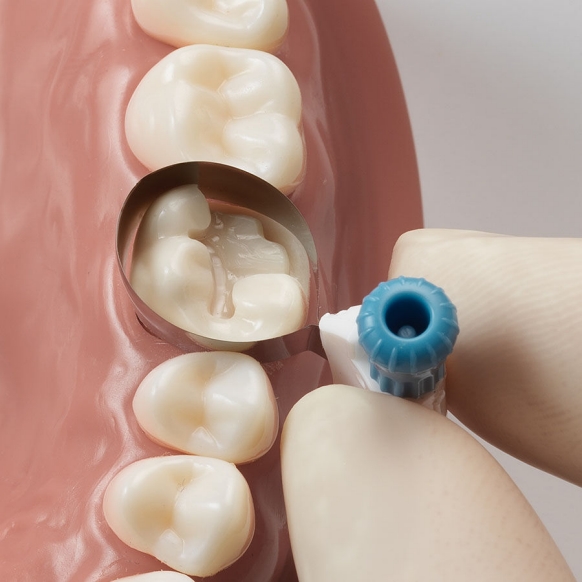 Place Palodent 360