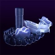 Digital impression: aligner, crown and screw