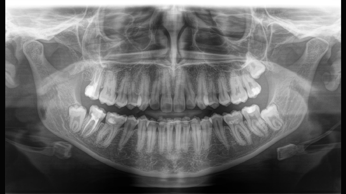 Orthophos SL 2D