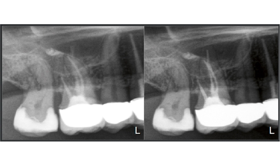 Orthophos SL 2D