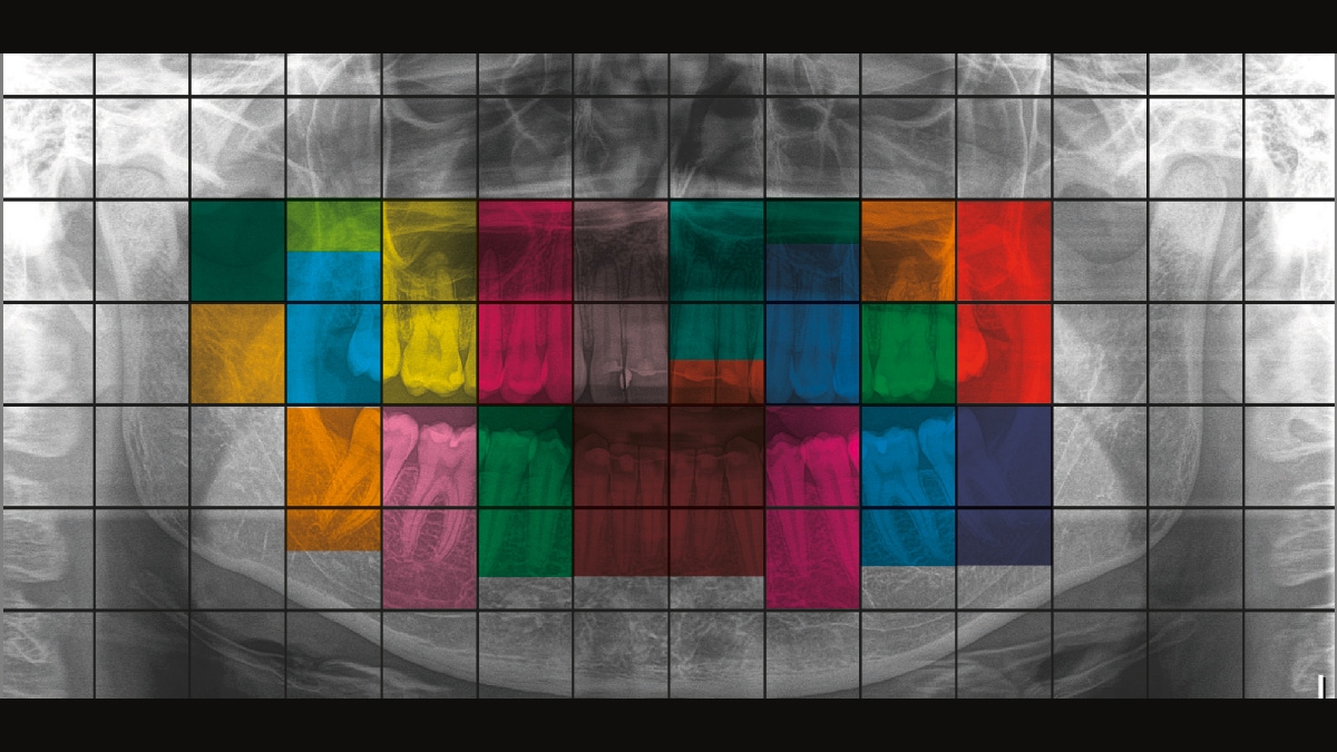 Radiografía con áreas de color