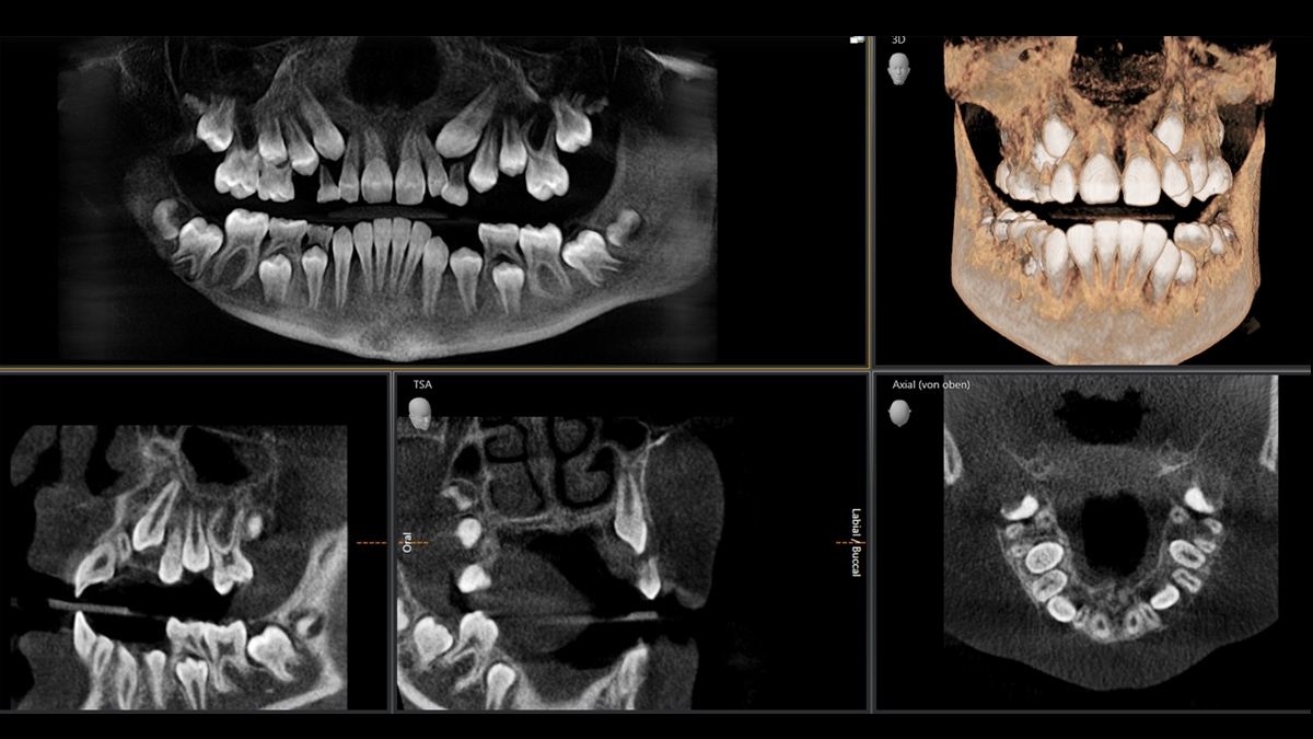 x-rays imaging