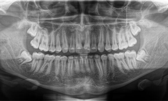 Radiografía 2D para toda la gama de dientes