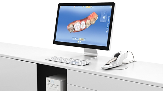 Screen with CEREC software and CEREC Omnicam