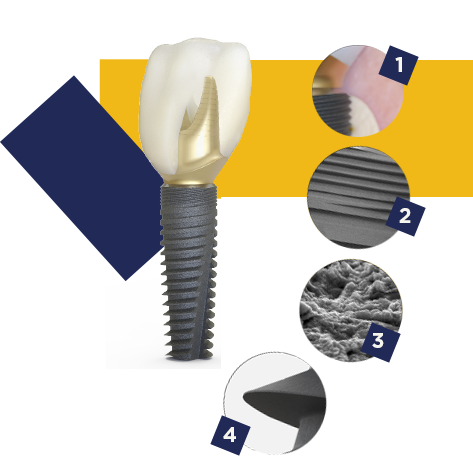 Astra Tech Implant EV