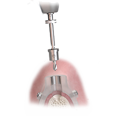 Sleeve-on drill