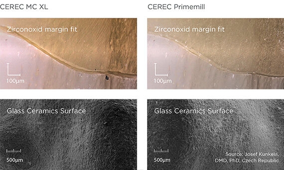 Confronto della struttura della superficie e del margine tra un restauro realizzato con CEREC MC XL e con CEREC Primemill