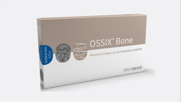 OSSIX Bone