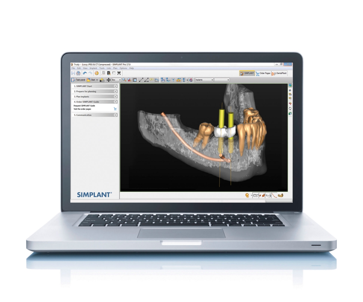 SICAT Implant