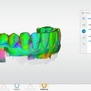 OraCheck patient monitoring software