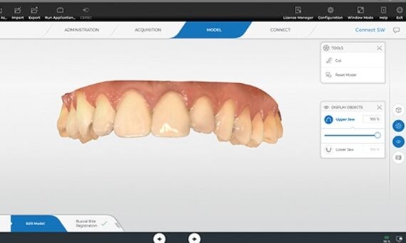 OraCheck export/import STL file