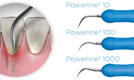 Powerline Ultrasonic Insert