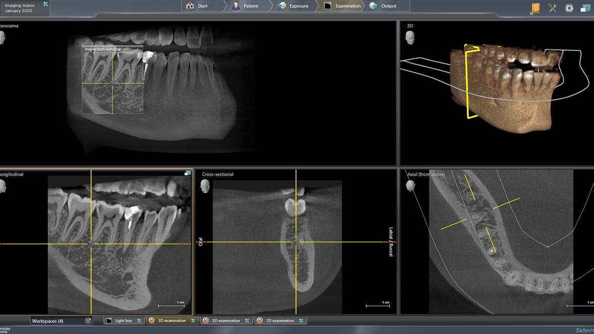 X-ray of digital dental unit Axeos 