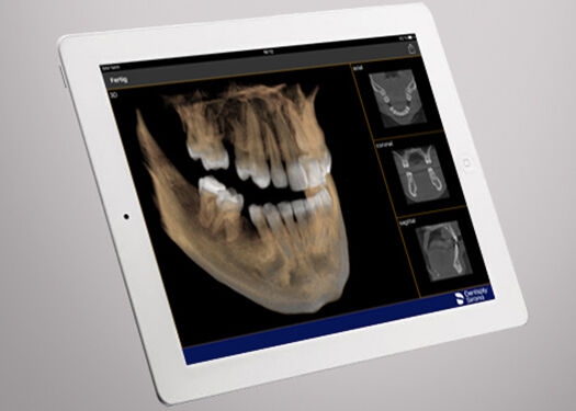 Mobile imaging data with Sidexis iX