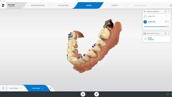View Model step, CEREC SW 5.2