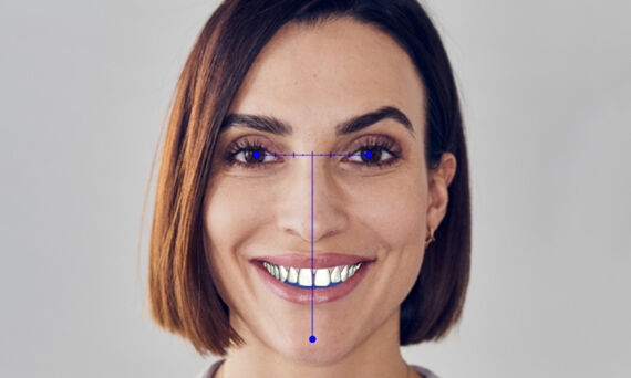 SureSmile Software Facial Axis