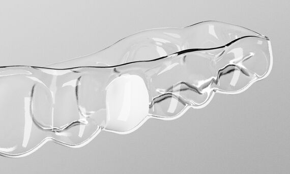 SureSmile Aligner Automatic Pontics