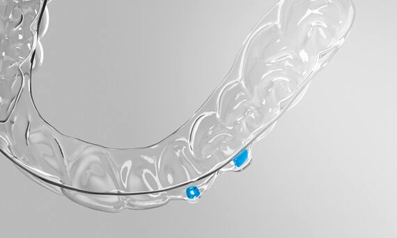 SureSmile Clear Aligner