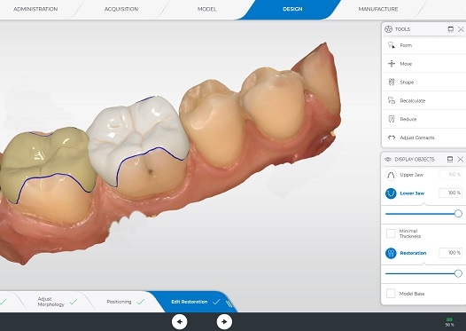 CEREC Software