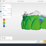 OraCheck patient monitoring software