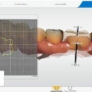 2D cross section with OraCheck