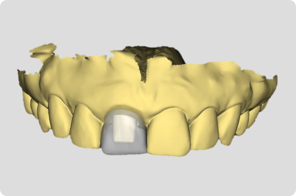 Digital clinical photography