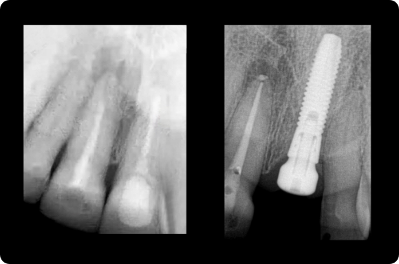 dental implant treatment planning