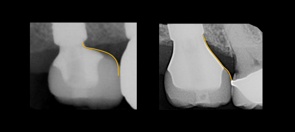 Digital clinical photography