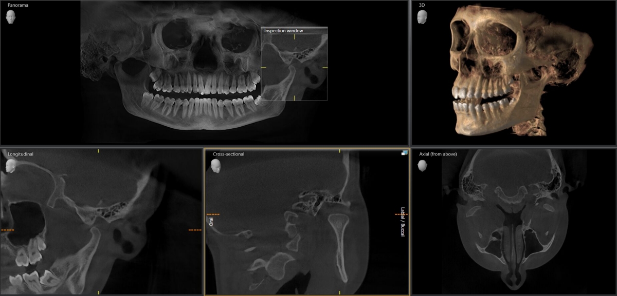 Axeos x-ray 