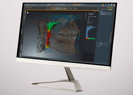 Monitor met de tandheelkundige software SICAT Air