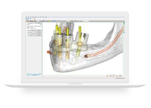 Monitor die de Simplant planningssoftware laat zien