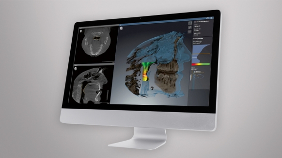 Monitor met de dentale software SICAT Air