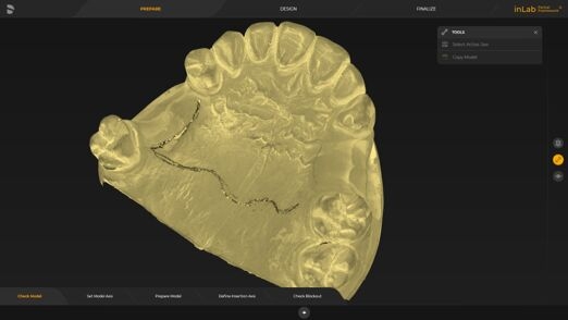 Texture scan with inEos X5