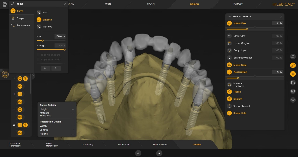 inLab CAD Software, Implantology module, screw retained bridge