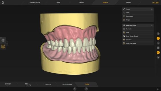 inLab CAD Software, removable partial dentures