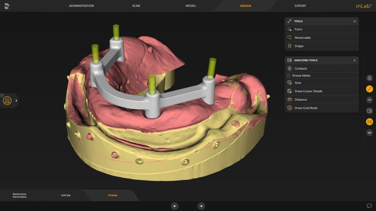 inLab CAD Software, standard bar