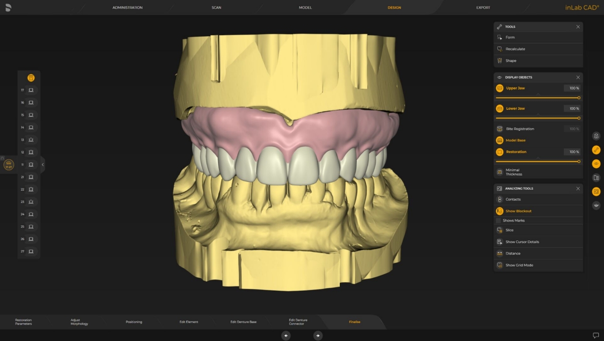 inLab CAD Software, individual impression tray