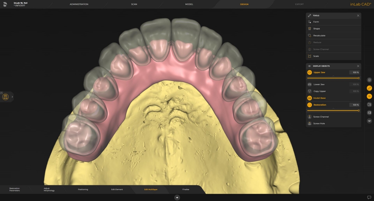 inLab CAD Software, Multi-layer-gingiva