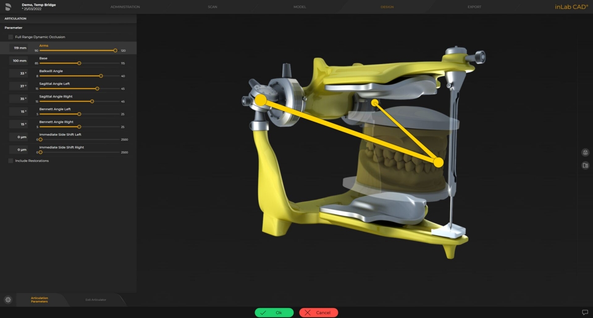 inLab CAD Software, Virtual articulator