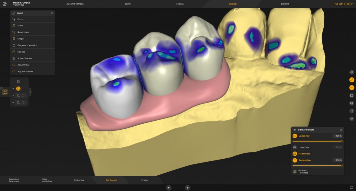 inLab CAD Software, Gingiva element design