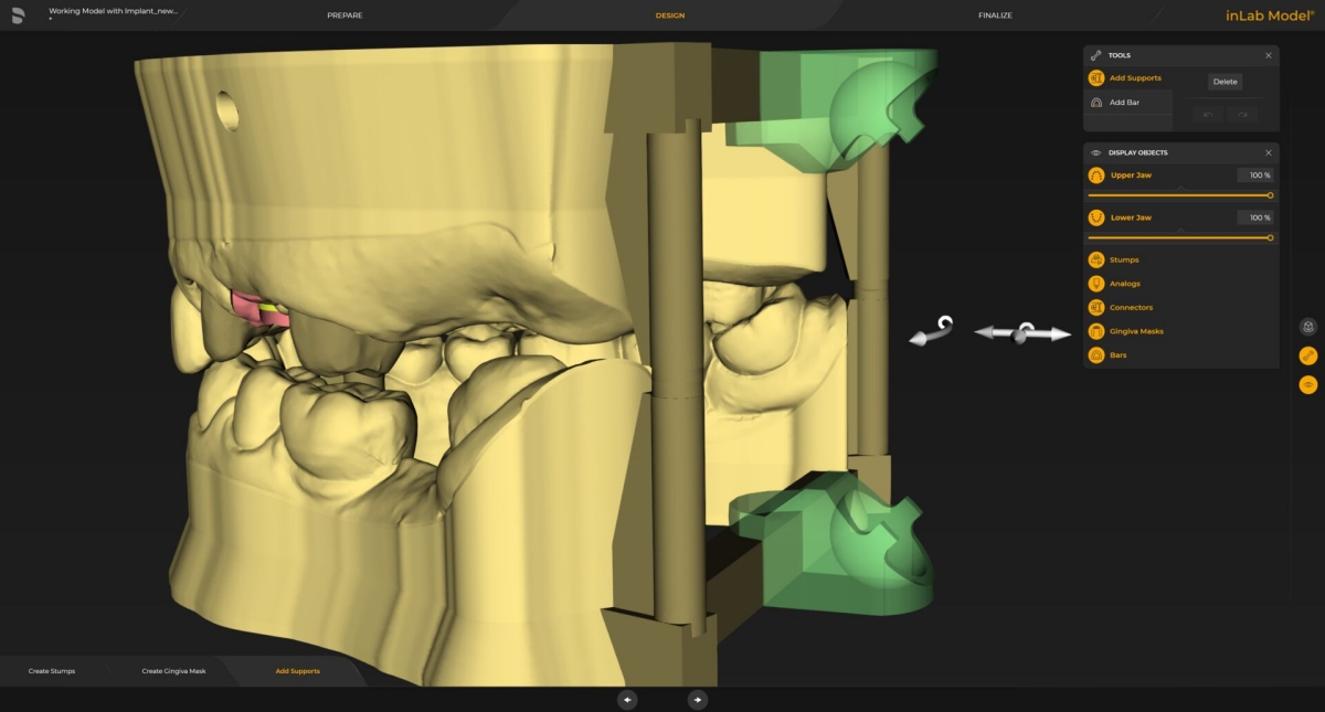 inLab CAD Software, Virtual data model with support structures