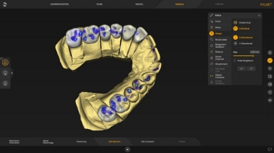 inLab CAD Software, Jaw-Oriented Biogeneric Setting