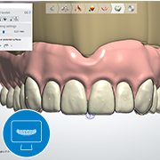 scanneng en ontwerpen van 3d geprinte prothese