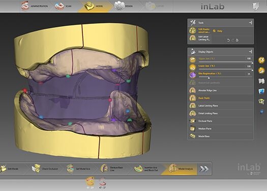 Digitale gebitsprothesen met inLab