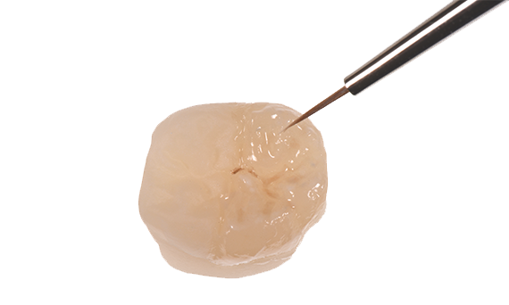 Celtra Press Occlusal Staining