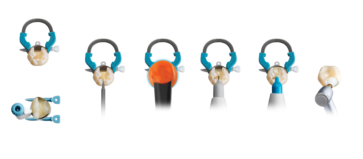 Standard Class II Solution Procedure with Dentsply Sirona