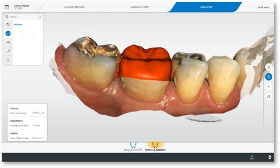 OraCheck Software, volume measurement